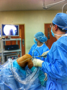 knee ortho surgery lutut